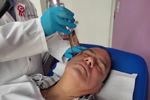 Rejuvenecimiento facial | Lepiel Clinica Laser | Eliminación de tatuajes image