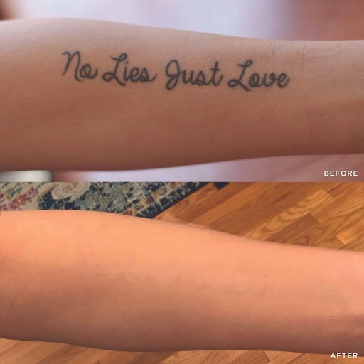 Explore sad tattoo ideas, creative tattoo ideas in Glen Mills, available at Removery Tattoo Removal & Fading
