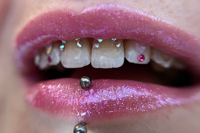 Gemtroptonsmile à Toulouse
