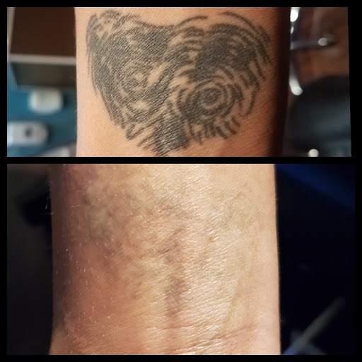 Explore thunderstorm tattoo ideas, creative tattoo ideas in Dubuque, available at Retrospect Tattoo Removal