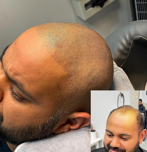 Explore life goes on tattoo ideas, creative tattoo ideas in Roseville, available at NuHair Ink. Scalp MicroPigmentation & Aesthetic Clinic of Sacramento