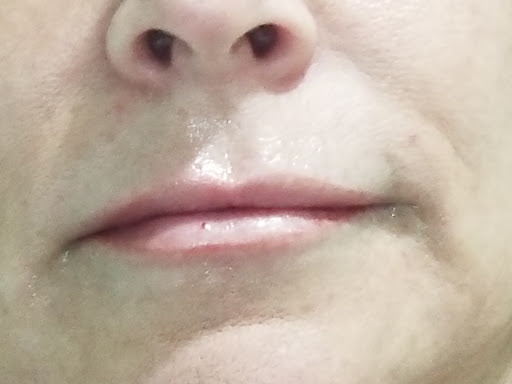 Medical Spa «New Image Medical Spa», reviews and photos, 680 Mowry Ave, Fremont, CA 94536, USA