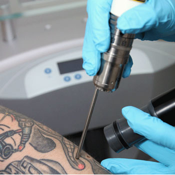 Explore video game tattoo ideas, creative tattoo ideas in Houston, available at Premium Tattoo Removal