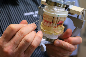 Mitchell dental laboratory - Denture repair