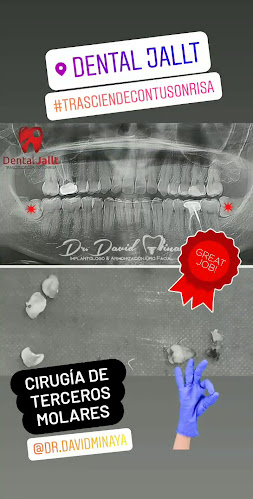 Dental Jallt - Quito
