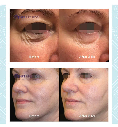 Explore teen wolf tattoo ideas, creative tattoo ideas in Owensboro, available at The Skin Lab