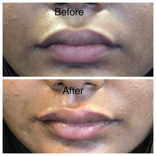 Explore impulse tattoo ideas, creative tattoo ideas in Eugene, available at Brighter Smiles Med Spa and Laser Center