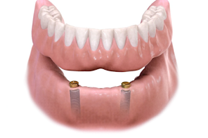 Hartman Dentistry image