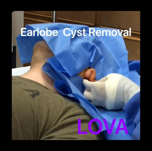 Explore mothman tattoo ideas, creative tattoo ideas in Lake Oswego, available at Lake Oswego Vein and Aesthetic LOVA