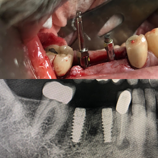 Torrance Oral Surgery and Dental Implant Center: Dr. Benjamin Yagoubian