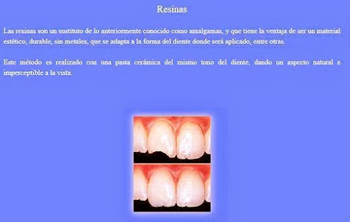 Dentistas en Puebla Clinica Dental Spota