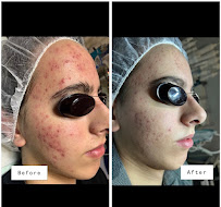 Clear Beauty Acne Clinic - Photo 9 - Car repair in Frisco, TX, Frisco