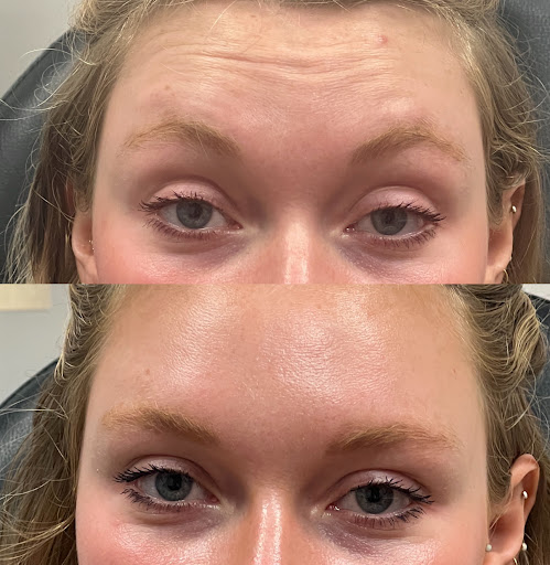 Explore travel tattoo ideas, creative tattoo ideas in Chesapeake, available at Dermacare of Hampton Roads