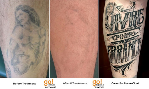 Explore tribal tattoo cover up ideas, creative tattoo ideas in Allentown, available at Removery Tattoo Removal & Fading