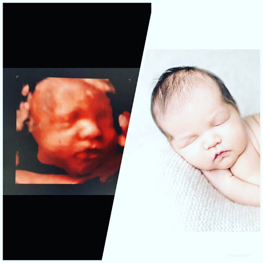 Medical Diagnostic Imaging Center «My little baby 4d & boutique», reviews and photos, 8930 TX-121, McKinney, TX 75070, USA