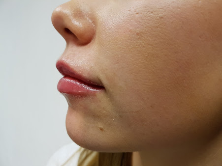 مركز إريان للجراحة التجميلية - ليستر - The Erian Centre for Cosmetic Surgery - Leicester