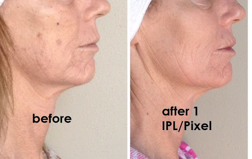 Medical Spa «All About You Med Spa», reviews and photos, 2410 S Gilbert Rd, Chandler, AZ 85286, USA