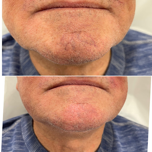 Explore tattoos inner bicep ideas, creative tattoo ideas in Owensboro, available at The Skin Lab