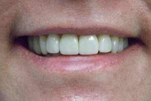 Arlington Comfort Dental image