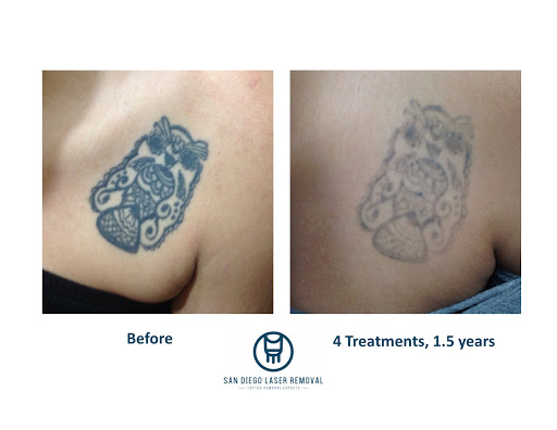 Explore german american tattoo ideas, creative tattoo ideas in San Diego, available at Removery Tattoo Removal & Fading