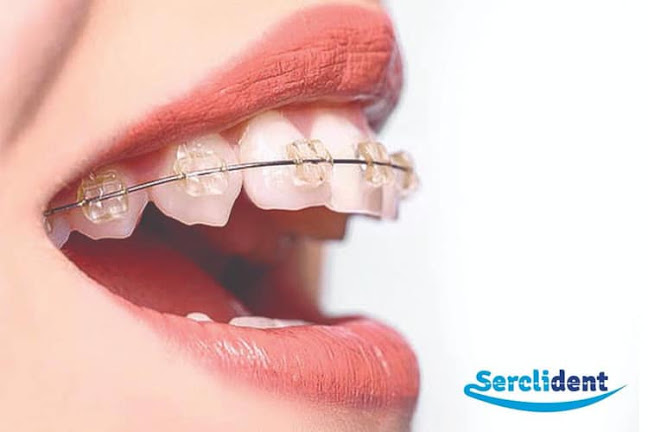 Comentarios y opiniones de SERCLIDENT N&G SERVICIOS DENTALES