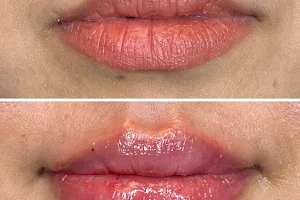 Nurture Medical Spa - Lip Fillers & Botox image
