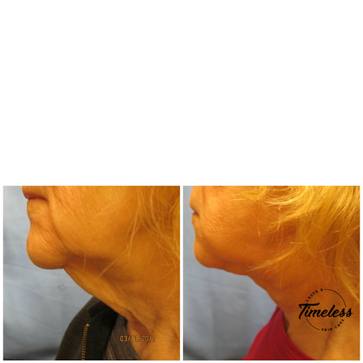 Skin Care Clinic «Timeless Laser & Skin Care», reviews and photos, 29160 Center Ridge Rd, Westlake, OH 44145, USA