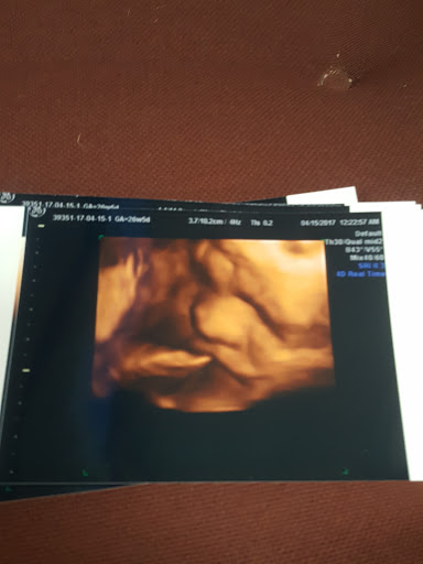 Houston Babies 4D Ultrasound