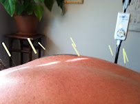 Piedmont Acupuncture & Oriental Medicine - Photo 6 - Car repair in Winston-Salem, NC, Winston-Salem