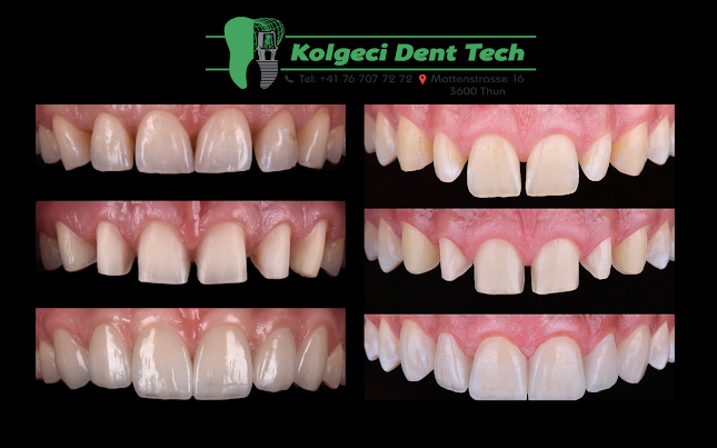 Kolgeci Dent Tech - Thun