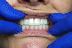 Smile Dental Services image