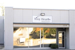 Tiny Hearts 4D Ultrasound image