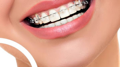 Dr Ahlem Ben Rayana- chirurgien dentiste et orthodontie à Noisy-le-Grand