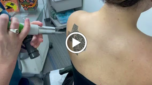 Explore divorce tattoo ideas, creative tattoo ideas in San Antonio, available at South West Tattoo Removal Program