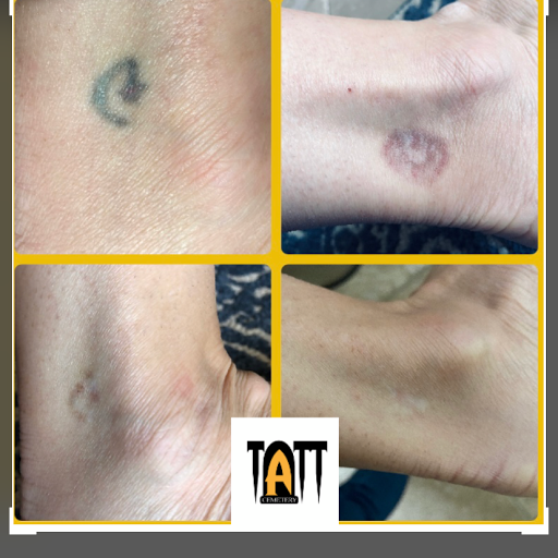 Explore guy leg tattoo ideas, creative tattoo ideas in Fort Myers, available at Laser Tattoo Removal by Tatt Cemetery