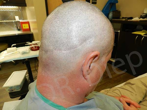 Hair Replacement Service «Medical Hair Transplants & Aesthetics», reviews and photos, 15055 Los Gatos Blvd Suite #110, Los Gatos, CA 95032, USA