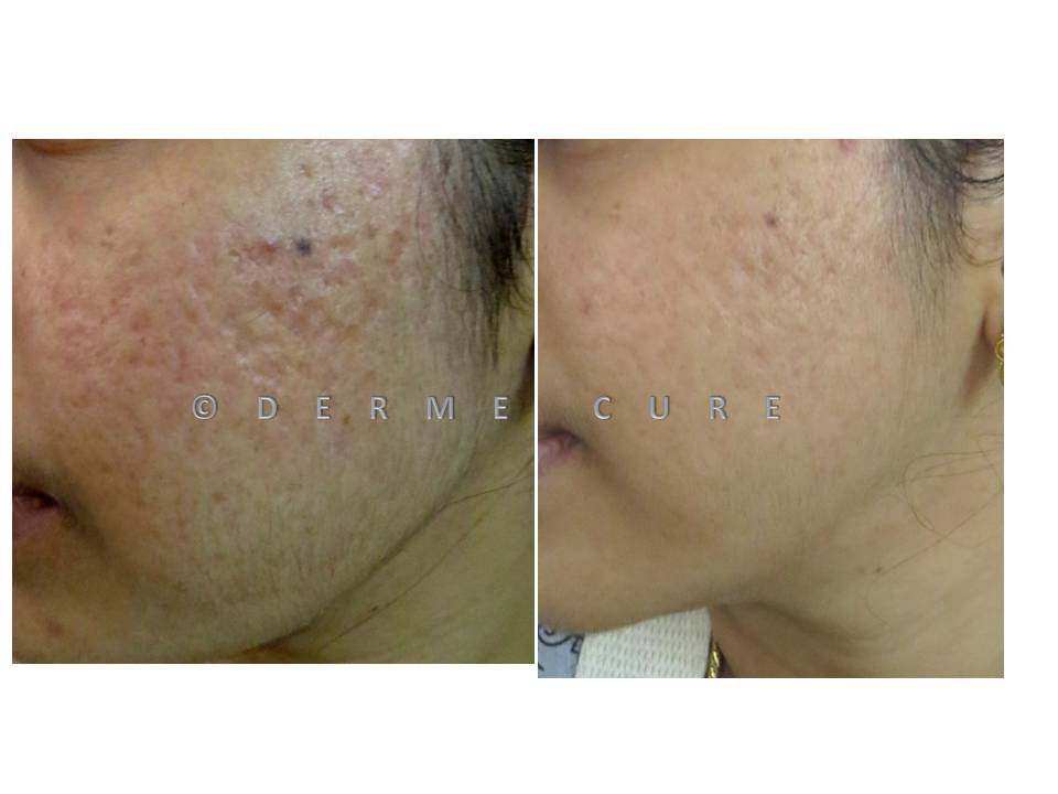 DermeCure Skin and Cosmetic clinic