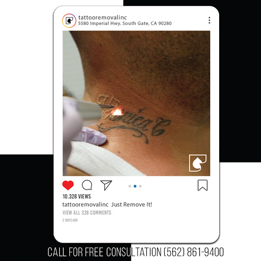 Explore mens collarbone tattoo ideas, creative tattoo ideas in South Gate, available at Tattoo Removal Inc