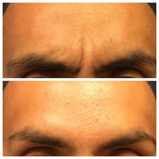 Explore rose hand tattoo ideas, creative tattoo ideas in Lake Oswego, available at Lake Oswego Vein and Aesthetic LOVA