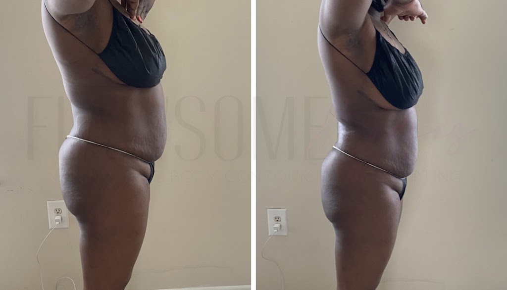 Flawsome Bodies 21207