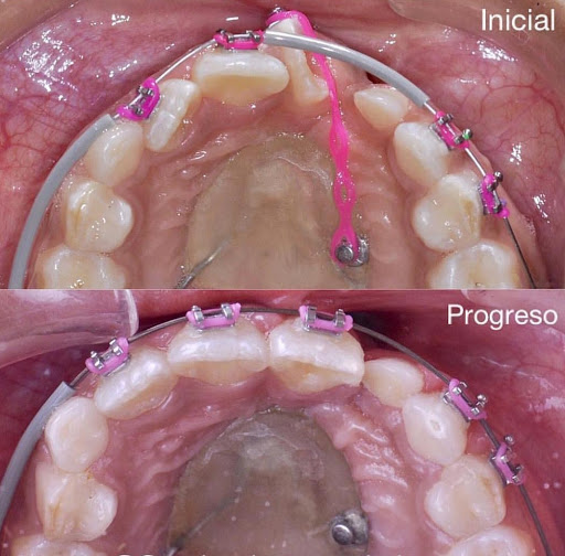 Dental Kids, Ortodoncia El Salvador | Dr. Carlos Rivas