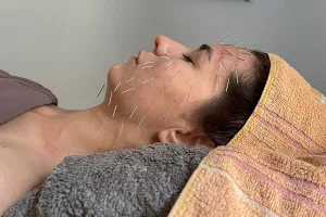 Acupuncture & Massage Medical image