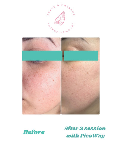 Explore mom son tattoo ideas, creative tattoo ideas in Temecula, available at Erase & Embrace Tattoo Removal