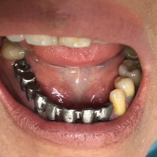 Opiniones de Dr. Victor Manuel Segarra. Odontología Restauradora e Implantes en Guayaquil - Dentista