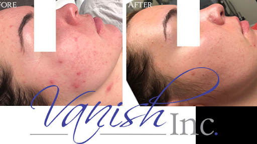 Explore new life tattoo ideas, creative tattoo ideas in Williamsport, available at Vanish Laser & Skin, Inc.