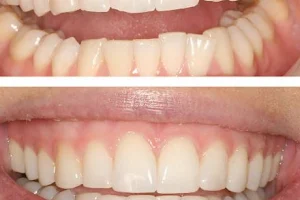 White Pearl Denta Care - Dental Clinic Elamakkara, Dental Clinic Kochi, Dental Clinic Kaloor, Dentist in Kochi image