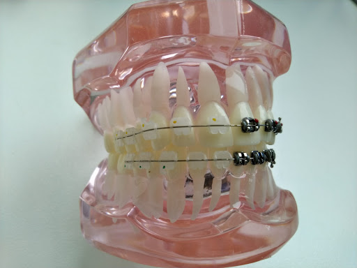 Implantare Soluções em Medicina Dentária