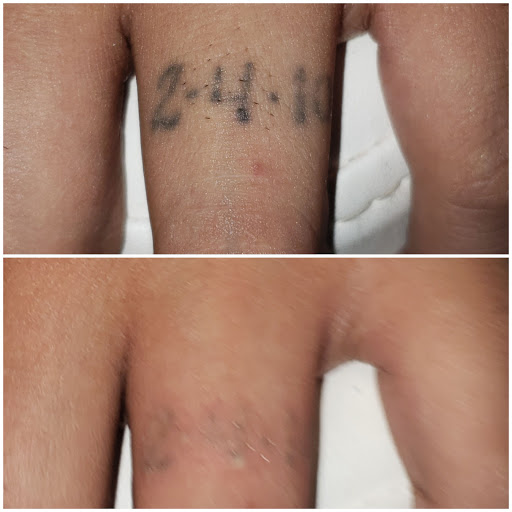 Explore music inspired tattoo ideas, creative tattoo ideas in Houston, available at Htown Lasers