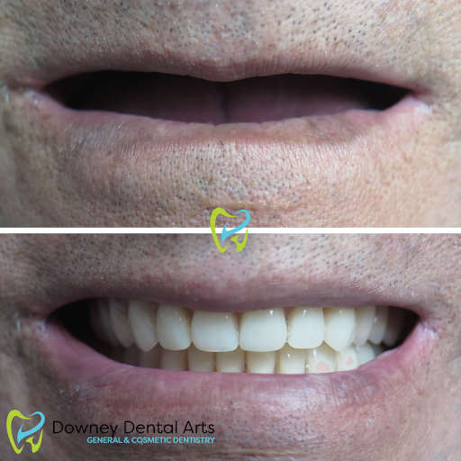 Downey Dental Arts image