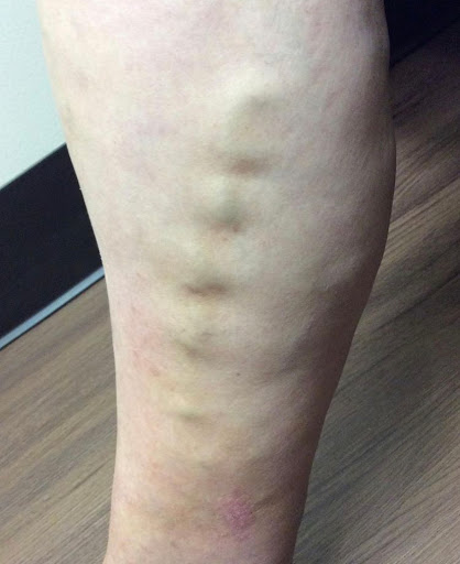 Explore movie tattoo ideas, creative tattoo ideas in Lake Oswego, available at Lake Oswego Vein and Aesthetic LOVA